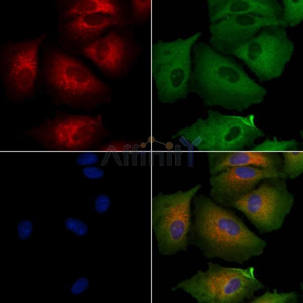 TRIM3 Antibody - AF0453 staining A549 cells by IF/ICC.