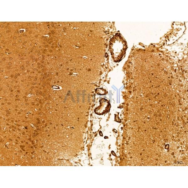 HIF1A Antibody - AF1009 at 1/100 staining Rat brain tissue by IHC-P.