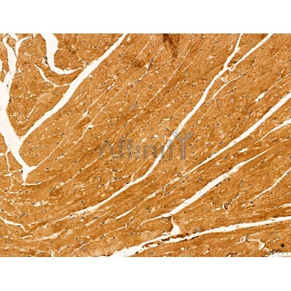 HIF1A Antibody - AF1009 at 1/100 staining Mouse heart tissue by IHC-P.