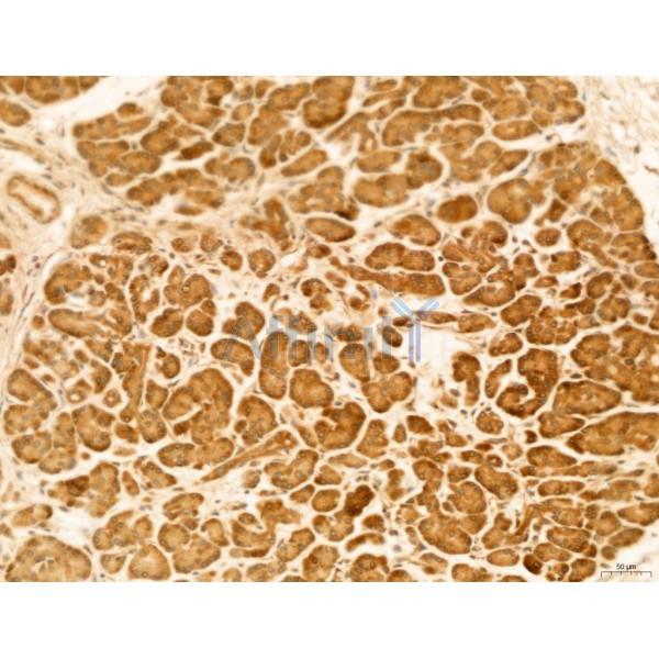 HIF1A Antibody - AF1009 at 1/100 staining Human normal tissues adjacent to pancreatic cancer by IHC-P.