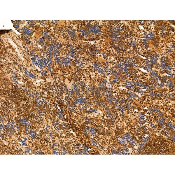 HIF1A Antibody - AF1009 at 1/100 staining Rat spleen tissue by IHC-P.
