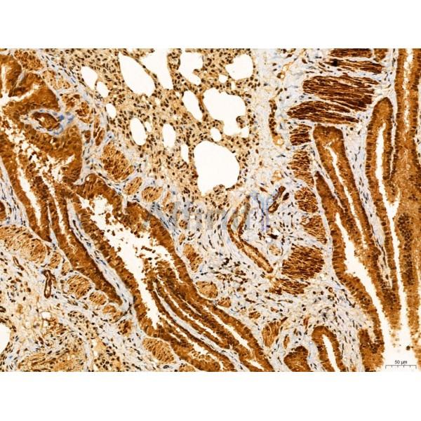 HIF1A Antibody - AF1009 at 1/100 staining Rat lung tissue by IHC-P.