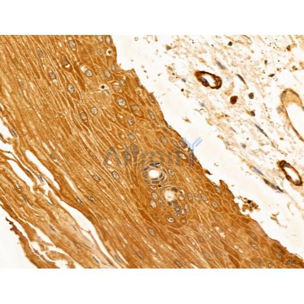 HIF1A Antibody - AF1009 at 1/100 staining Human normal tissues adjacent to esophageal cancer by IHC-P.