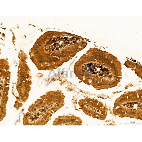 HIF1A Antibody - AF1009 at 1/100 staining Mouse colon tissue by IHC-P.