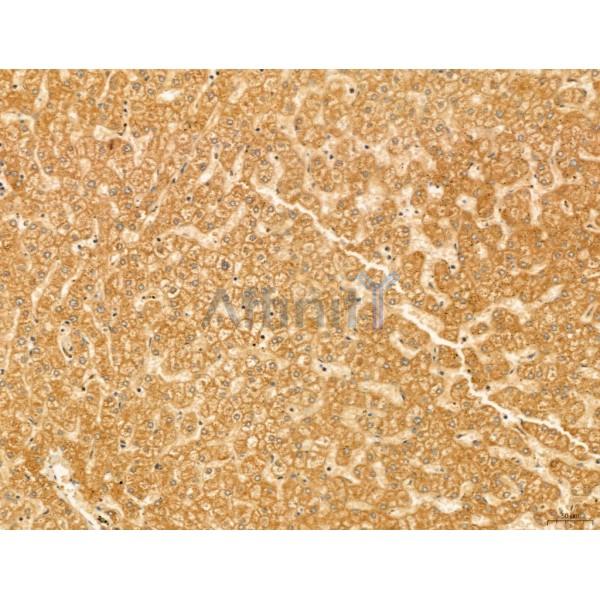 HIF1A Antibody - AF1009 at 1/100 staining Human normal tissues adjacent to liver cancer by IHC-P.