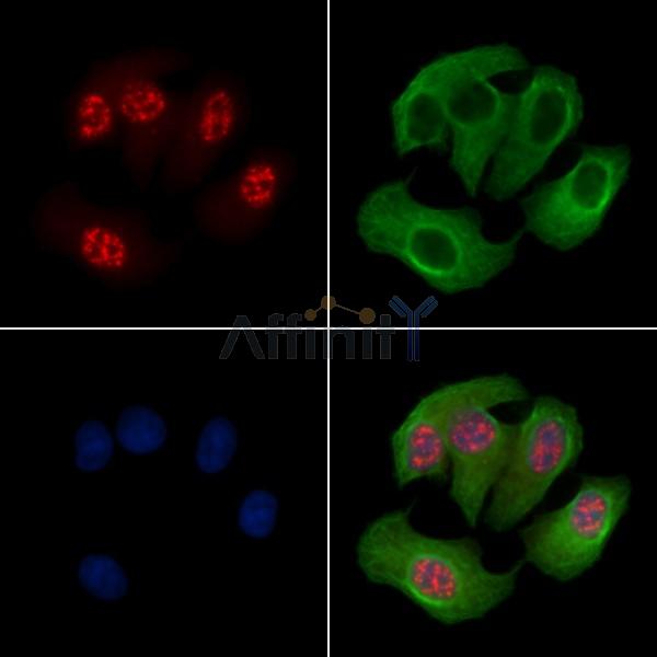 Phospho-MAPKAPK2 (Thr222) Antibody - AF2361 staining Heat-shock treated Hela cells by IF/ICC.