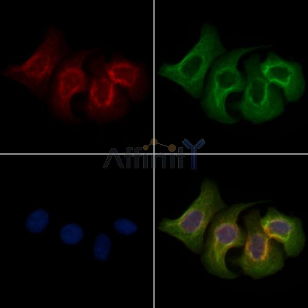 Phospho-PAK1 /PAK2 (Ser199/Ser204, Ser192/Ser197) Antibody - AF2380 staining Heat-shock treated Hela cells by IF/ICC.