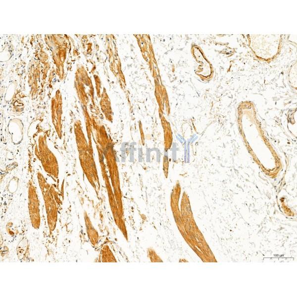 TGFBR1 Antibody - AF5347 at 1/100 staining Human normal tissues adjacent to esophageal cancer by IHC-P.