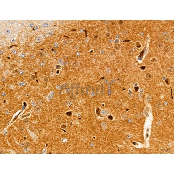 TGFBR1 Antibody - AF5347 at 1/100 staining Mouse brain tissue by IHC-P.