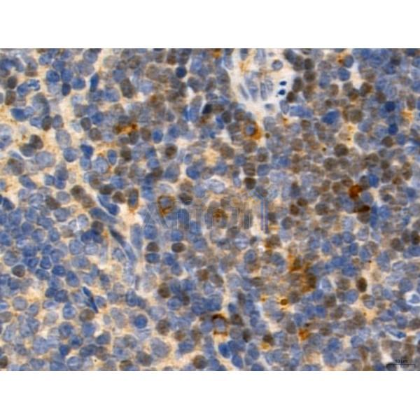 TGFBR1 Antibody - AF5347 at 1/100 staining Mouse spleen tissue by IHC-P.