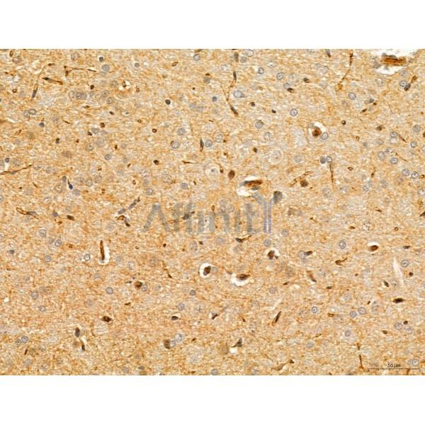 TGFBR1 Antibody - AF5347 at 1/100 staining Rat brain tissue by IHC-P.