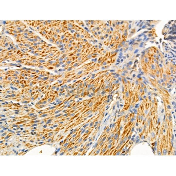 TGFBR1 Antibody - AF5347 at 1/100 staining Mouse ovary tissue by IHC-P.
