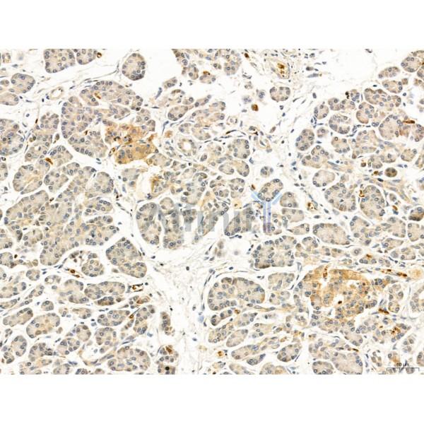 TGFBR1 Antibody - AF5347 at 1/100 staining Human normal tissues adjacent to pancreatic cancer by IHC-P.