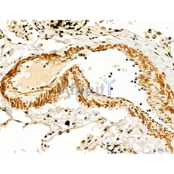 TGFBR1 Antibody - AF5347 at 1/100 staining Human normal tissues adjacent to lung cancer by IHC-P.