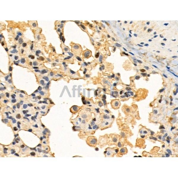 TGFBR1 Antibody - AF5347 at 1/100 staining Rat lung tissue by IHC-P.