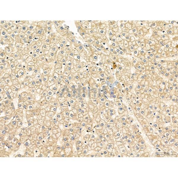 TGFBR1 Antibody - AF5347 at 1/100 staining Human normal tissues adjacent to liver cancer by IHC-P.