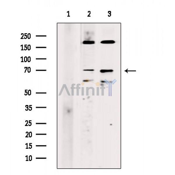 Rab11-FIP4 Antibody - Western blot analysis of extracts from various samples, using Rab11-FIP4 Antibody.