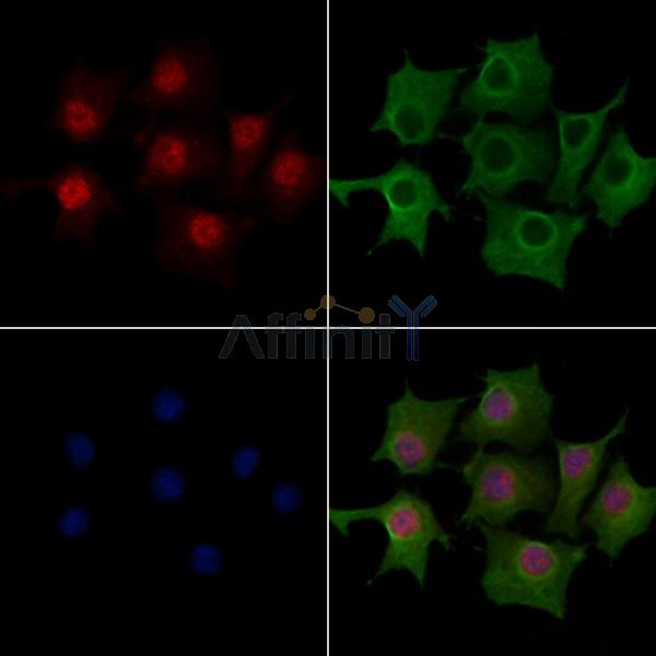 ATOH8 Antibody - DF10047 staining HepG2 cells by IF/ICC.