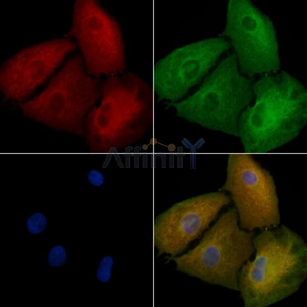 STRN Antibody - DF10123 staining A549 cells by IF/ICC.