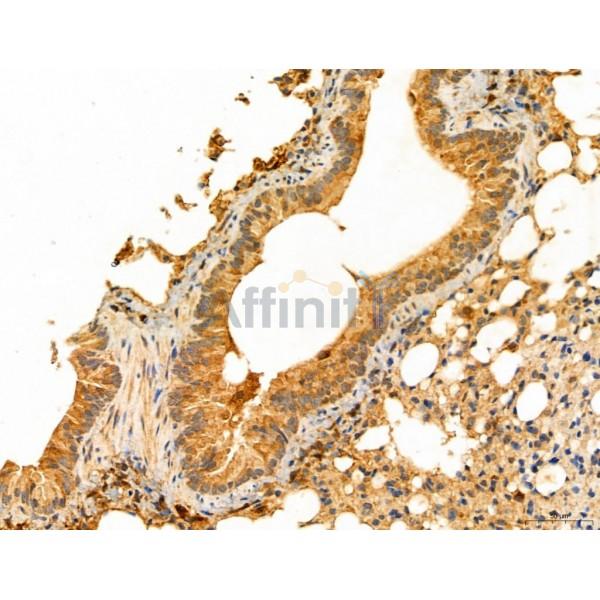 NOD2 Antibody - DF12125 at 1/100 staining Mouse lung tissue by IHC-P.