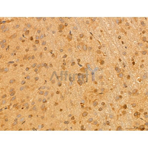 NOD2 Antibody - DF12125 at 1/100 staining Rat brain tissue by IHC-P.