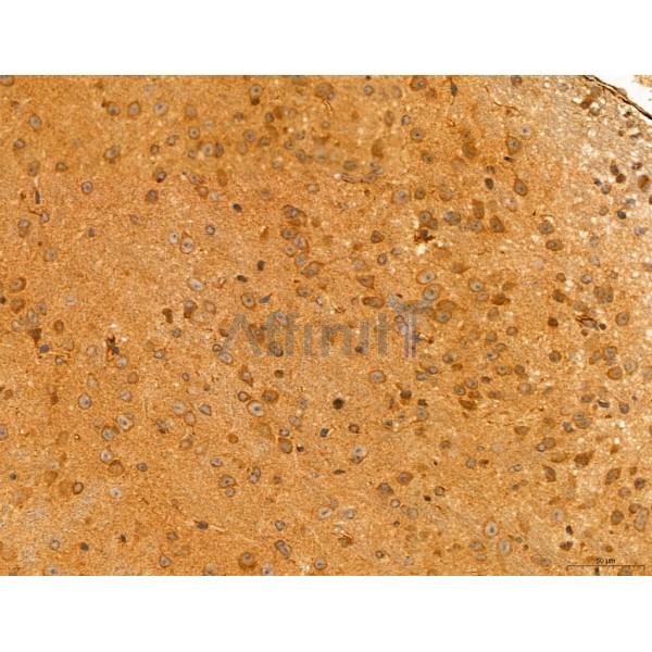 NOD2 Antibody - DF12125 at 1/100 staining Mouse brain tissue by IHC-P.