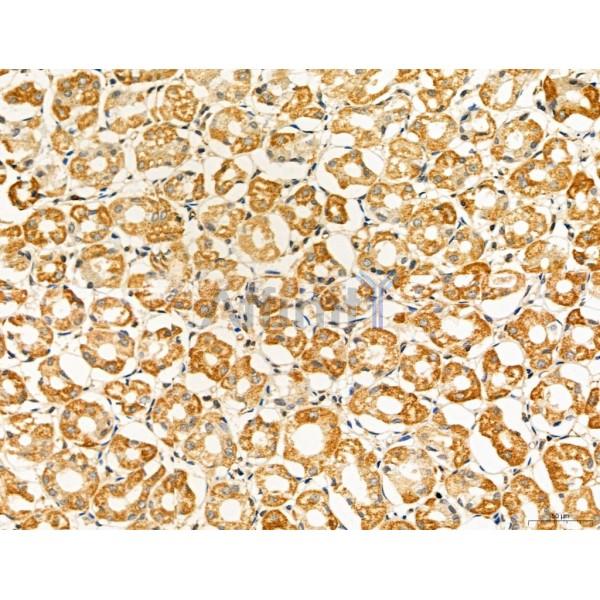 NOD2 Antibody - DF12125 at 1/100 staining Human normal tissues adjacent to gastric cancer by IHC-P.