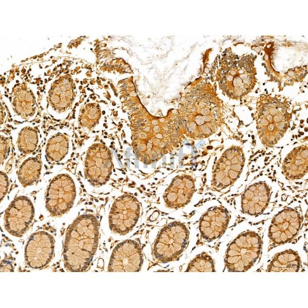 NOD2 Antibody - DF12125 at 1/100 staining Human normal tissues adjacent to colorectal cancer by IHC-P.