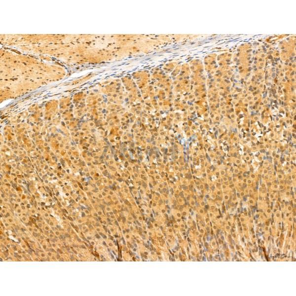 NOD2 Antibody - DF12125 at 1/100 staining Rat stomach tissue by IHC-P.