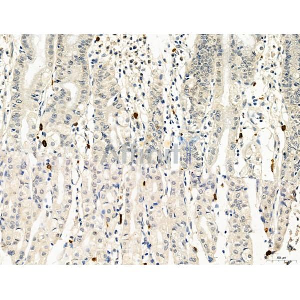 PDLIM7 Antibody - DF12130 at 1/100 staining Human normal tissues adjacent to gastric cancer by IHC-P.