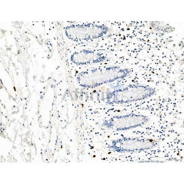 PDLIM7 Antibody - DF12130 at 1/100 staining Human normal tissues adjacent to colorectal cancer by IHC-P.