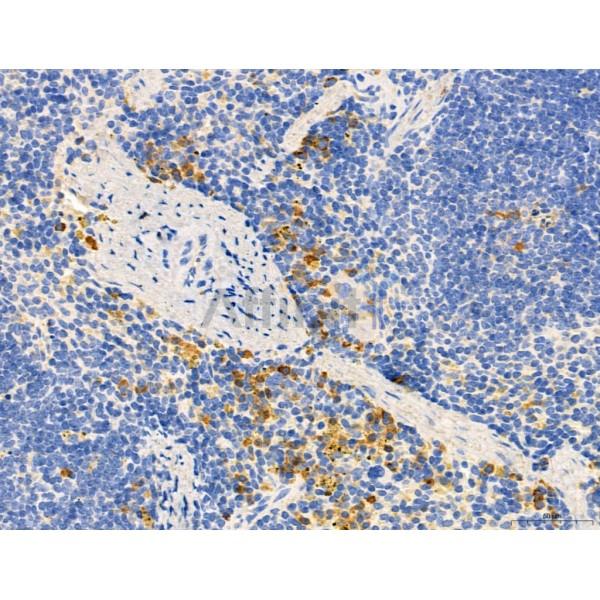 PDLIM7 Antibody - DF12130 at 1/100 staining Mouse spleen tissue by IHC-P.