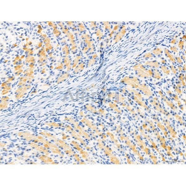 PDLIM7 Antibody - DF12130 at 1/100 staining Rat stomach tissue by IHC-P.