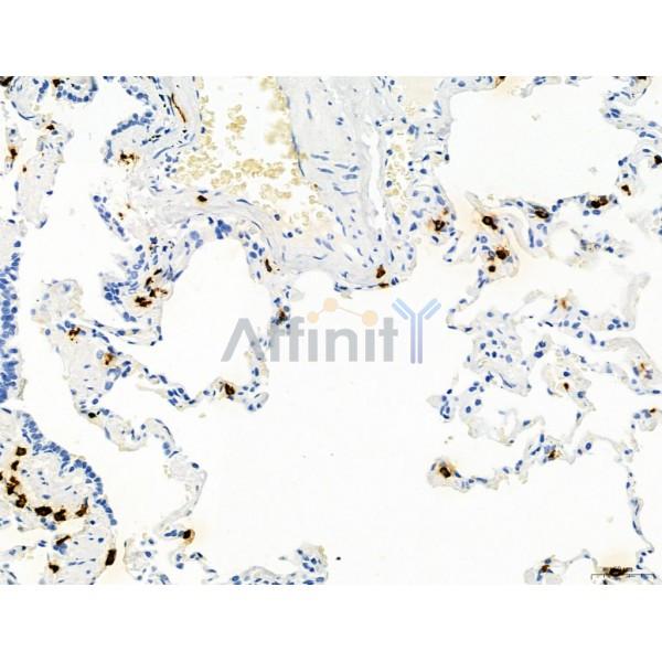 PDLIM7 Antibody - DF12130 at 1/100 staining Human normal tissues adjacent to lung cancer by IHC-P.