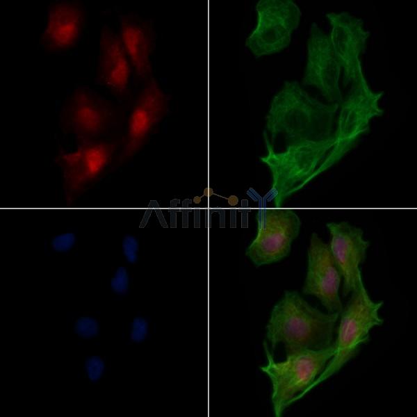 SMYD3 Antibody - DF12477 staining A549 cells by IF/ICC.