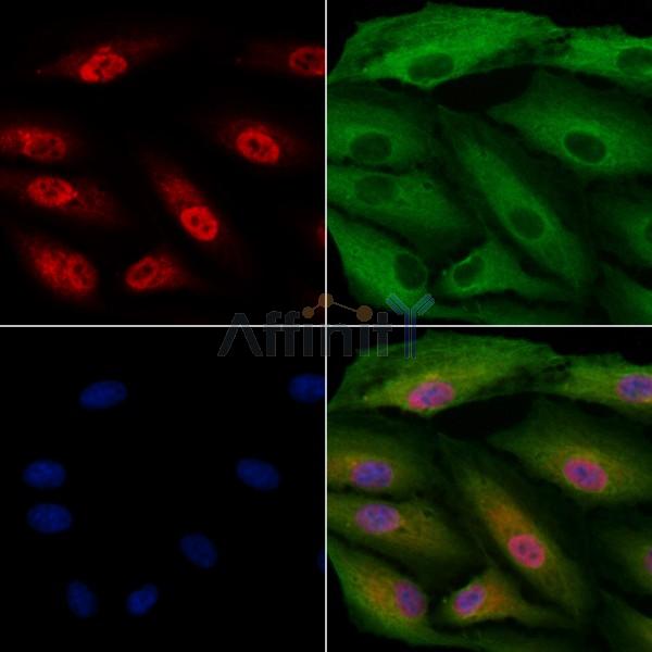IMPDH1 Antibody - DF12642 staining A549 cells by IF/ICC.
