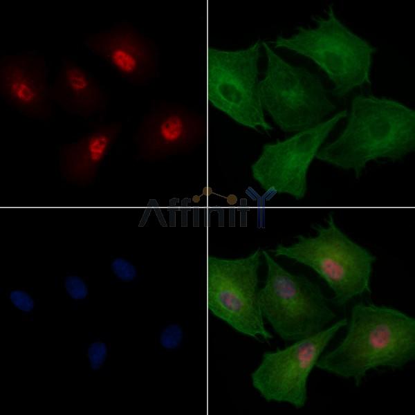SNRPN Antibody - DF12744 staining A549 cells by IF/ICC.