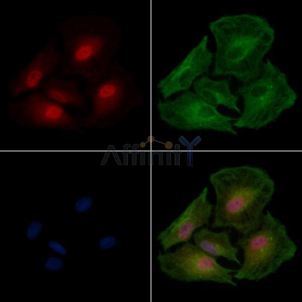 EIF4H Antibody - DF12975 staining A549 cells by IF/ICC.