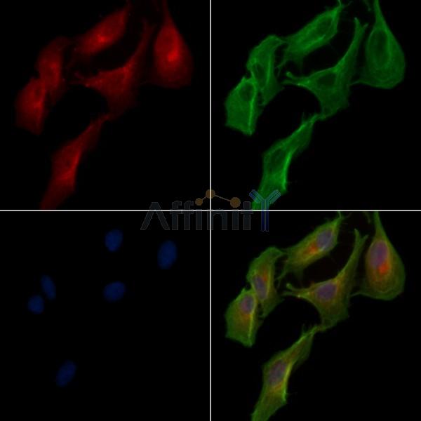 LACTB Antibody - DF13120 staining A549 cells by IF/ICC.