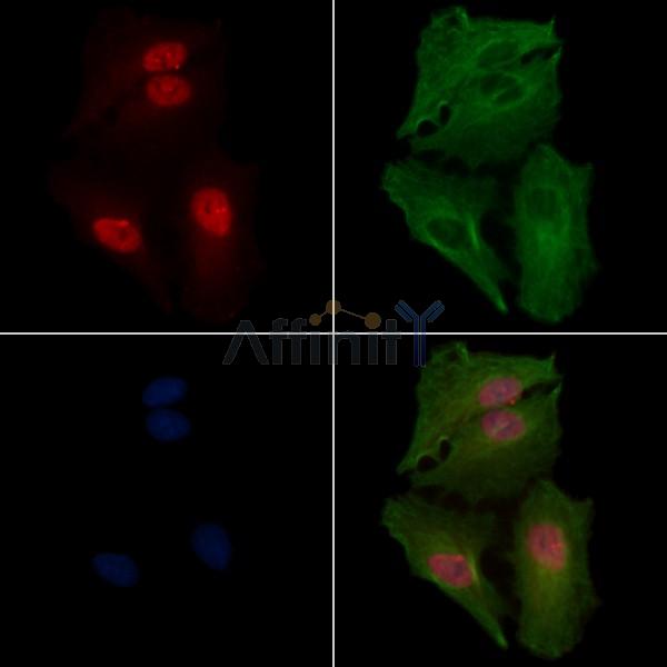 NDOR1 Antibody - DF13177 staining A549 cells by IF/ICC.