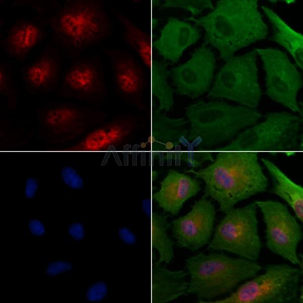 Stra8 Antibody - DF13234 staining A549 cells by IF/ICC.