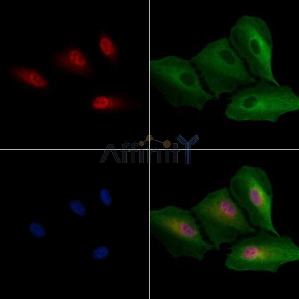 macroH2A.1 Antibody - DF13300 staining A549 cells by IF/ICC.