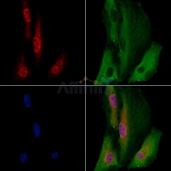 EBF2 Antibody - DF13398 staining A549 cells by IF/ICC.