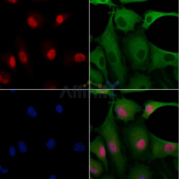 FKBP25 Antibody - DF13423 staining A549 cells by IF/ICC.