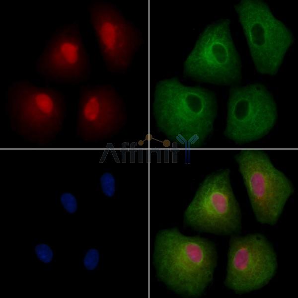CBX4 Antibody - DF13461 staining A549 cells by IF/ICC.