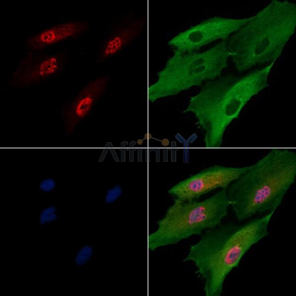 HLTF Antibody - DF13471 staining A549 cells by IF/ICC.