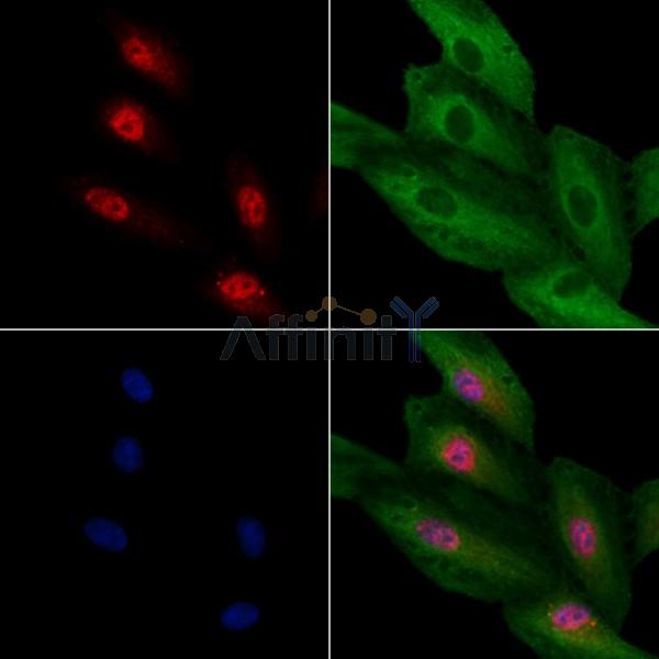 TCF21 Antibody - DF13477 staining A549 cells by IF/ICC.