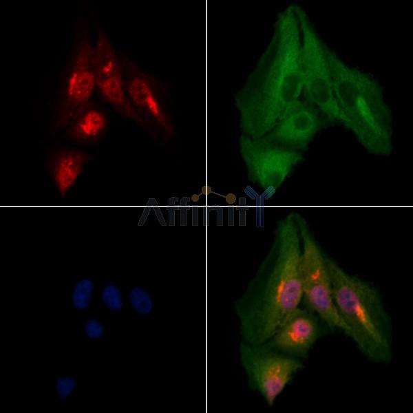 PGP Antibody - DF13507 staining A549 cells by IF/ICC.