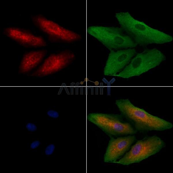 MST4 Antibody - DF13525 staining A549 cells by IF/ICC.