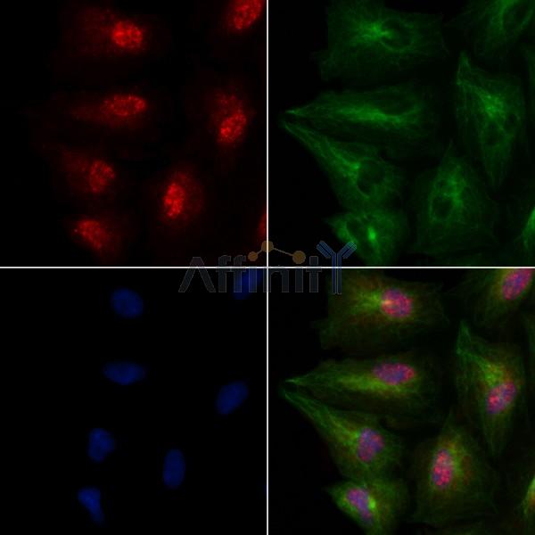 PSPC1 Antibody - DF2220 staining A549 cells by IF/ICC.